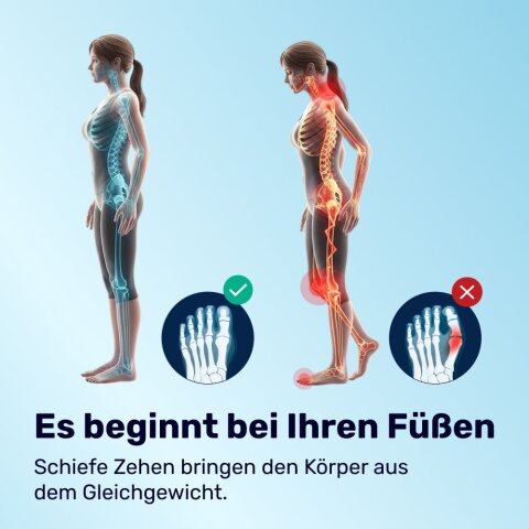 OrthoToe image